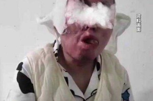 女生遭男友殴打致残 法医不予鉴定的社会之痛，家暴致残法医拒鉴，社会之痛与司法失能